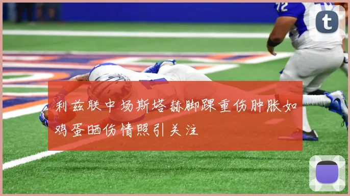 利兹联中场斯塔赫脚踝重伤肿胀如鸡蛋晒伤情照引关注